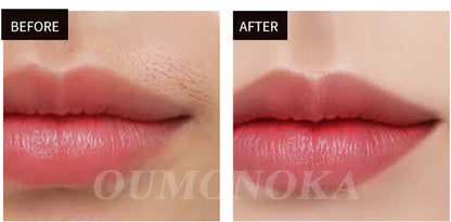 Permanent Laser Epilierer